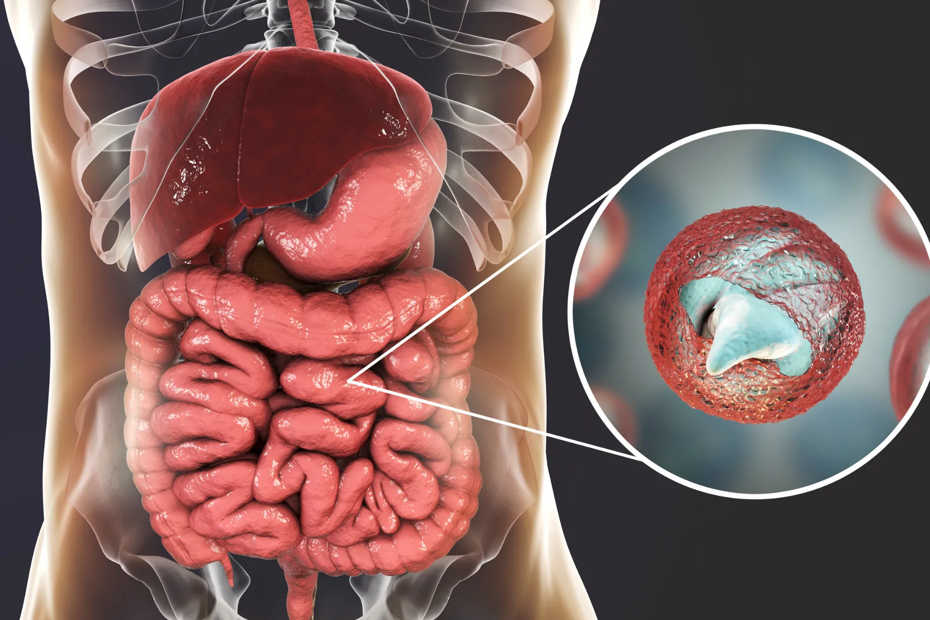 Intestinal Invaders Analysis